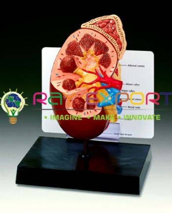 Human Kidney On Stand