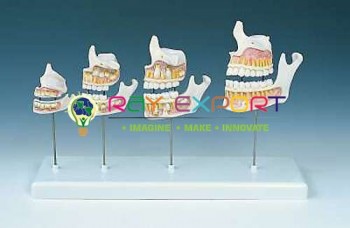 Human Teeth Model, Dentition Development on Stand