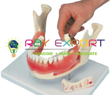 Human Teeth Model, Lower Jaw