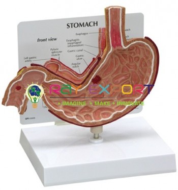 Human Stomach Anatomy Model For Biology Lab