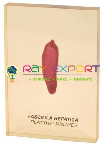 Fasciola (Liver Fluke)